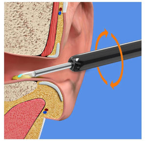 Earwax Removal Kit - Safe Ear Cleaner | Nazzah